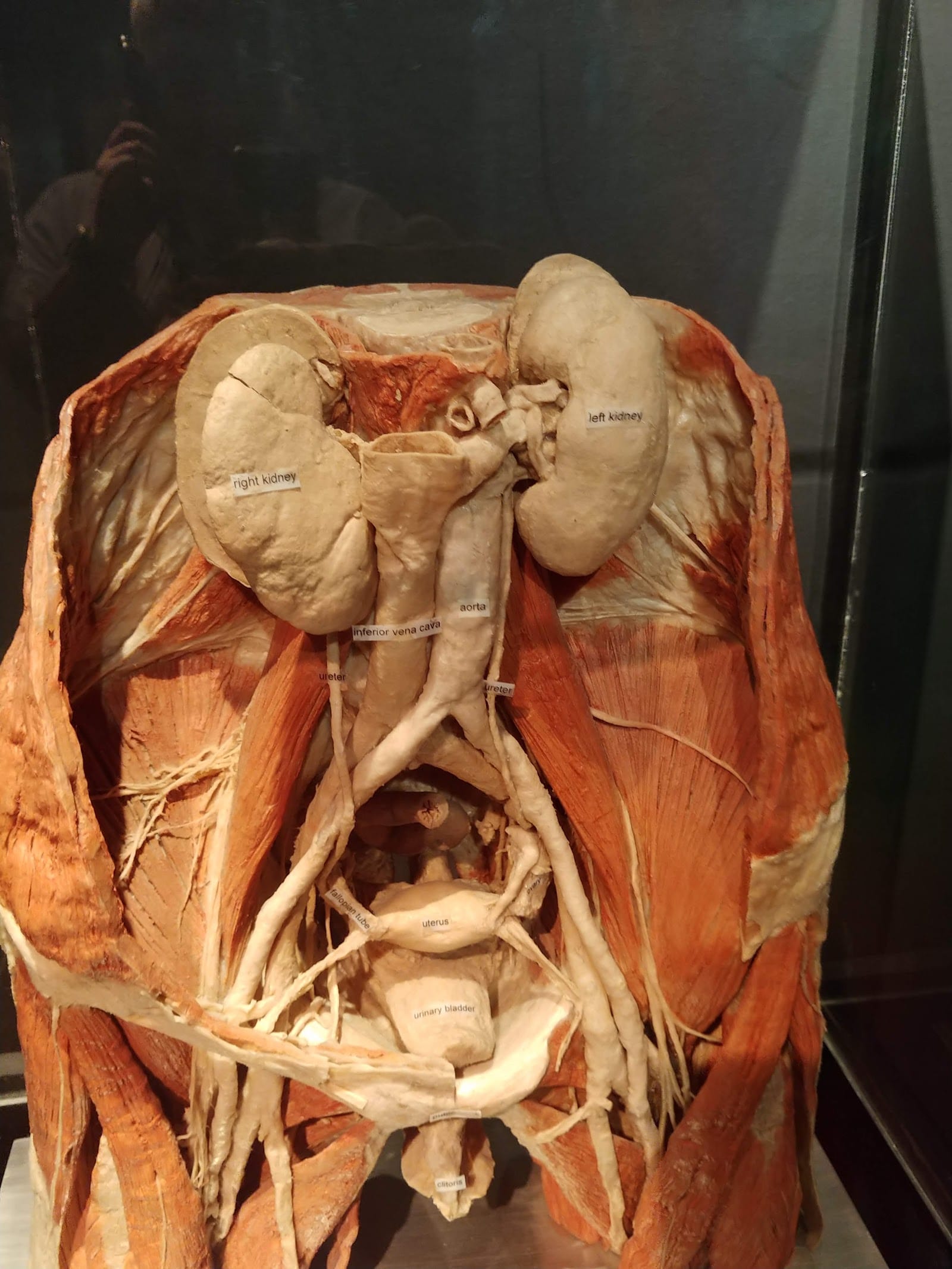 Body Worlds Amsterdam Tickets: What to Know Before You Go — photo