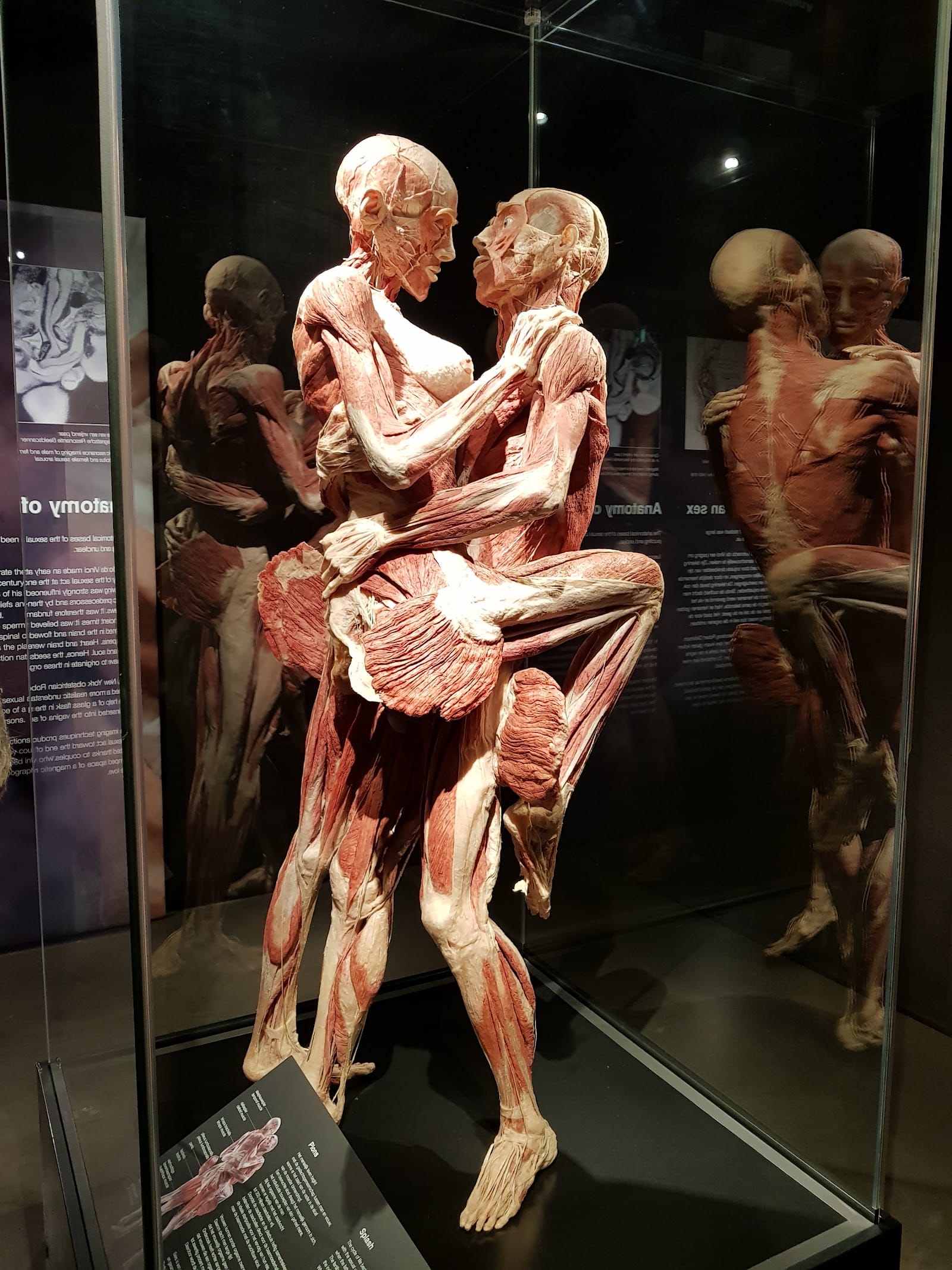 Body Worlds Amsterdam Tickets: What to Know Before You Go — photo